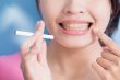 Tandverlies rokende vrouw