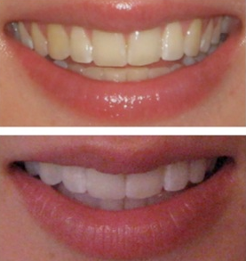 Een Gebit | Dentalzorg Tandheelkunde