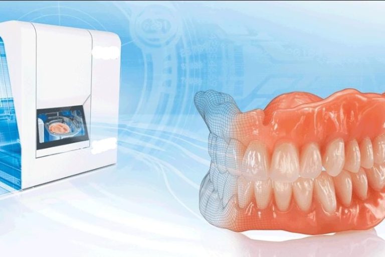 digitale prothese bij Dentalzorg